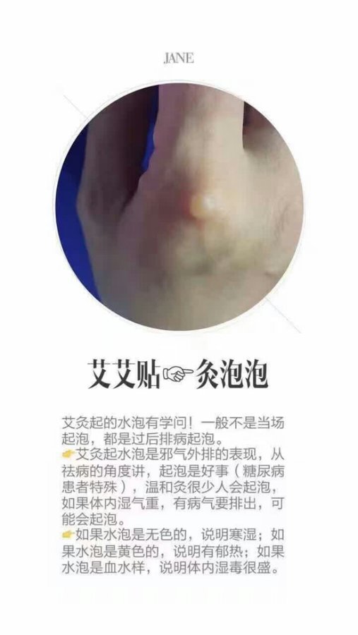 艾灸后皮肤发痒,真相惊人